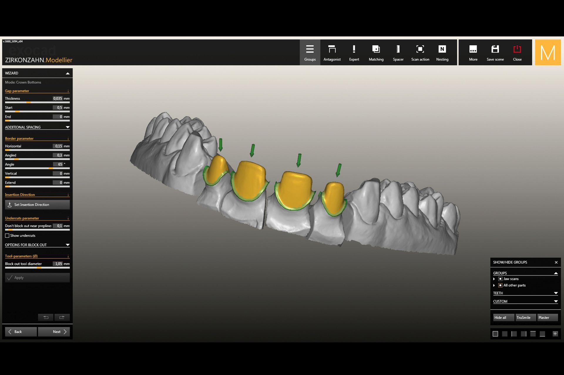 CAD/CAM System